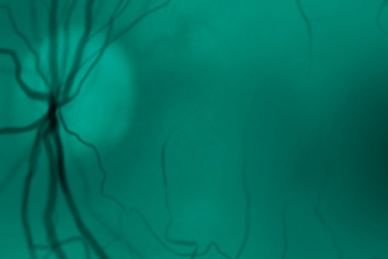 microscopic eye