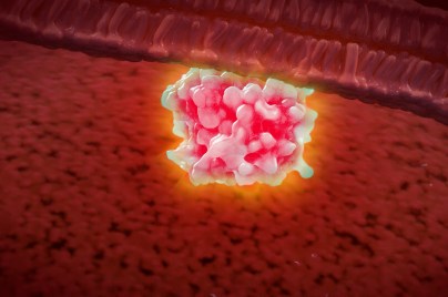 Image for Exploring KRAS: A precision approach in oncology