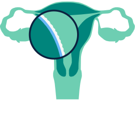 Icon of uterus