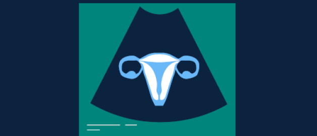 Illustration of ultrasound