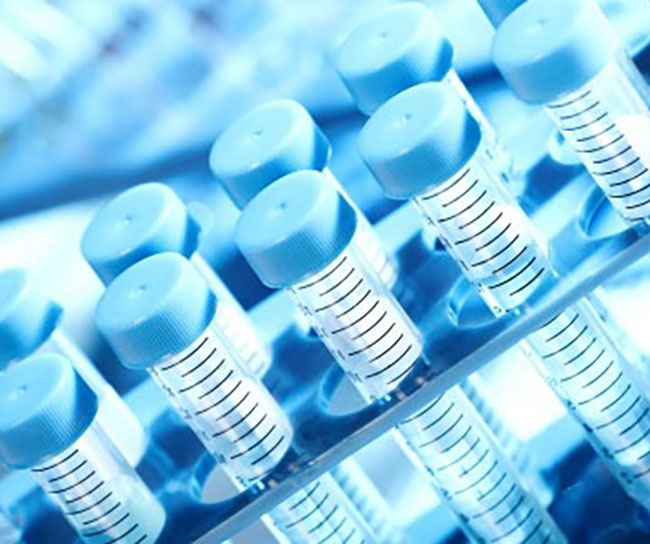 vaccines history vials