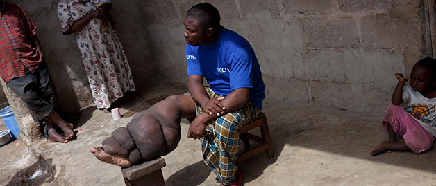 a man sitting with a swollen leg