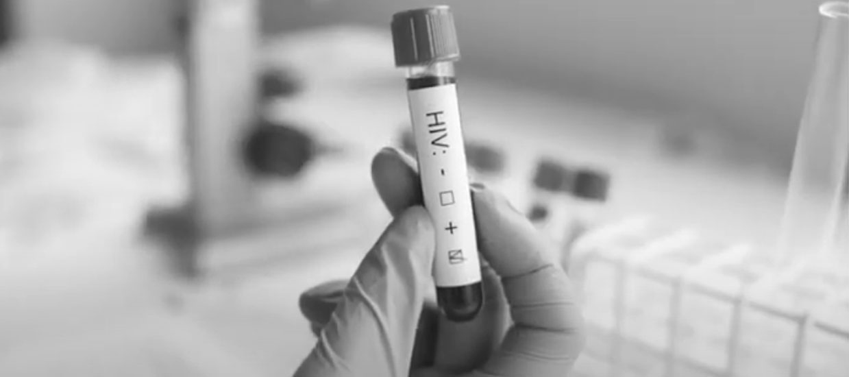 A vial of blood being checked for HIV