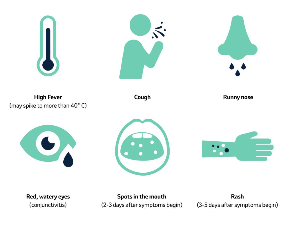 common measles symptoms