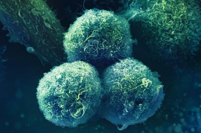 Microscopic view of three textured spherical cells