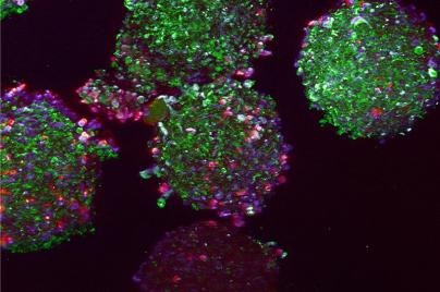 Neural-micro-spheroids