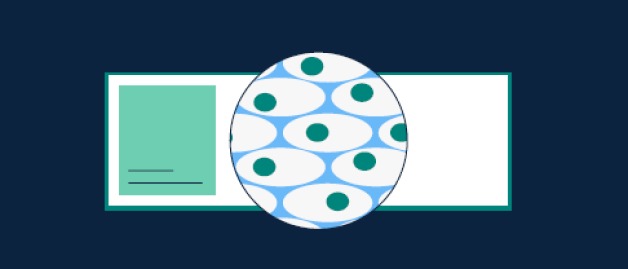 Illustration of biopsy