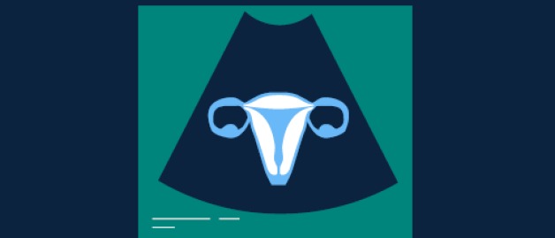 Illustration of ultrasound